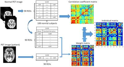 A Novel Individual Metabolic Brain Network for 18F-FDG PET Imaging